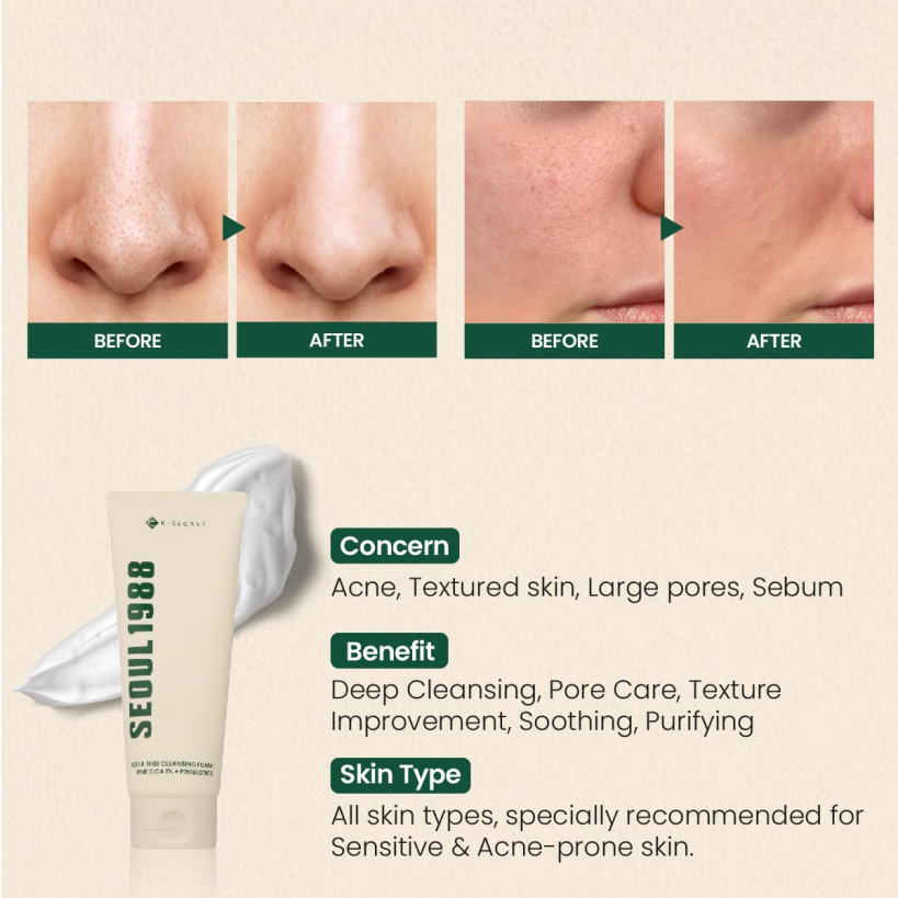 [K-SECRET] SEOUL 1988 Cleansing Foam : Pine Cica 1% + Probiotics 150ML
