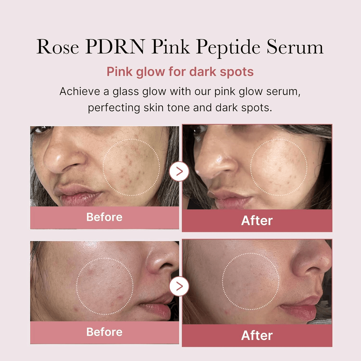 [MEDICUBE] PDRN Pink Peptide Serum 30ML