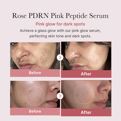 [MEDICUBE] PDRN Pink Peptide Serum 30ML