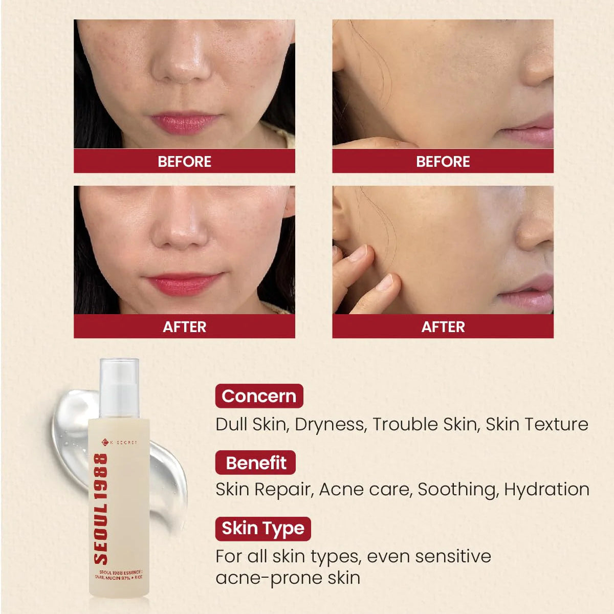 [K-SECRET] SEOUL 1988 Essence : Snail Mucin 97% + Rice 100ML