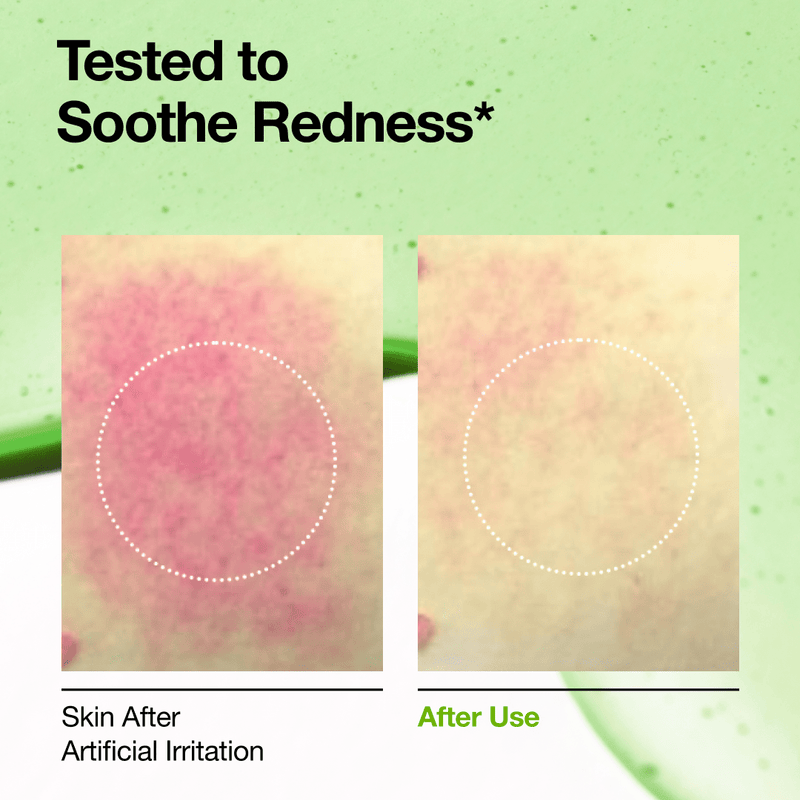 [ANUA] Azelaic Acid 10 Hyaluron Redness Soothing Serum 30ML