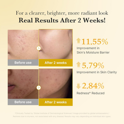 [MEDICUBE] Kojic Acid Turmeric Niacinamide Serum 30ml