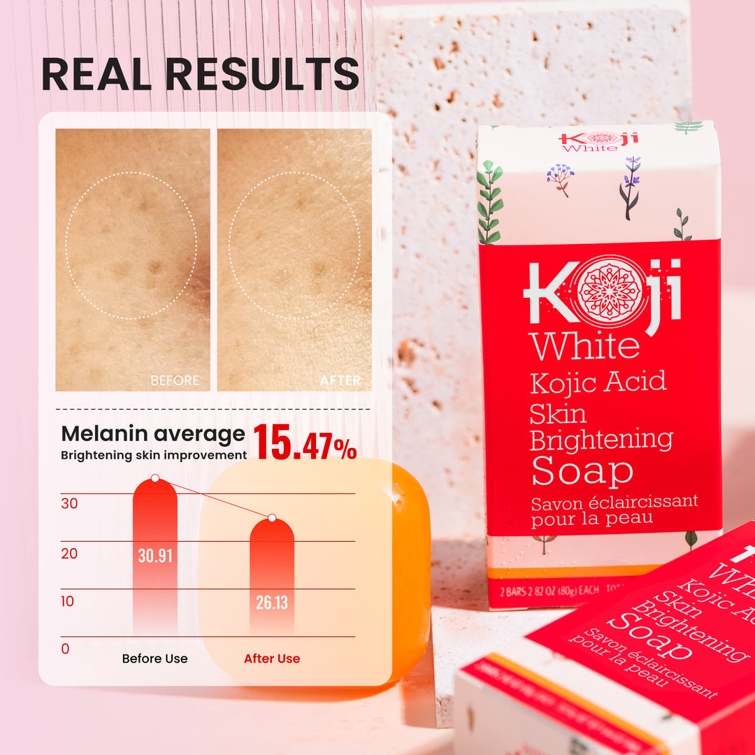 [KOJI WHITE] Kojic Acid Skin Brightening Soap 80g*2