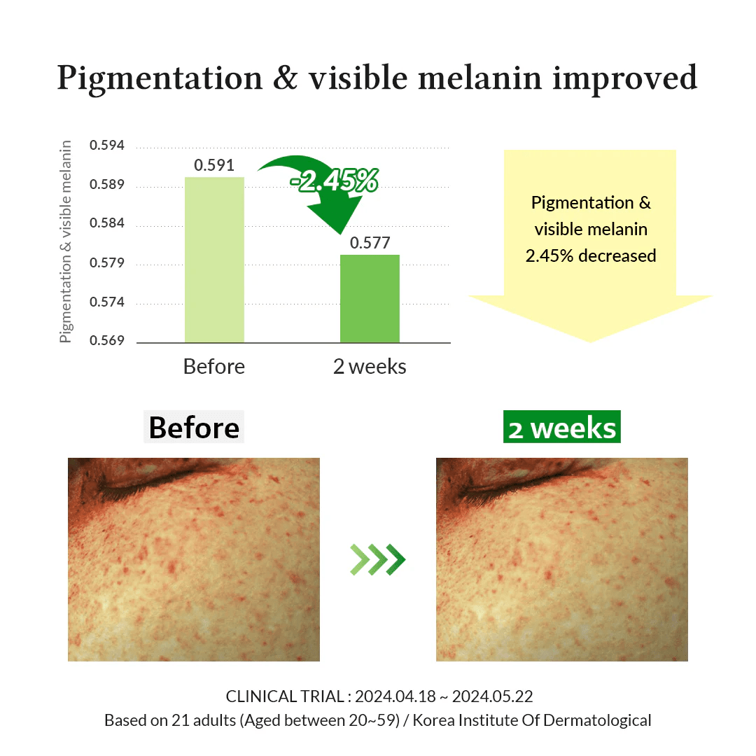 [DR. ALTHEA] Gentle Vitamin C Serum 30ml